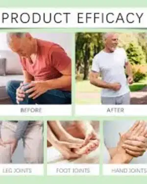 Miracle Balm for Edema