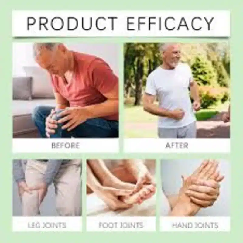Miracle Balm For Edema – Natural Soothing For Swelling &Amp; Discomfort – 30G - Recs-Medix Miracle balm for edema
